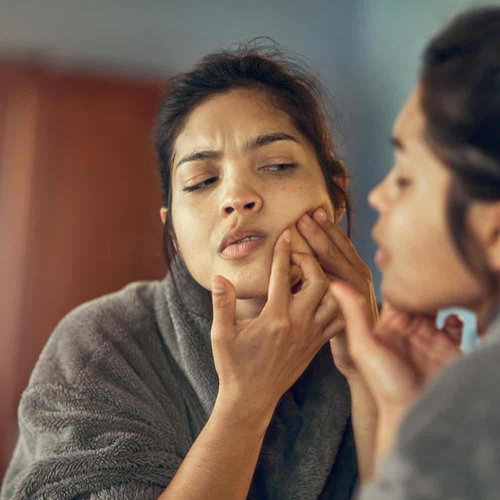 Acne & Pigmentation Care